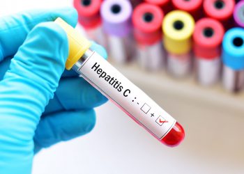 Hepatit C Hakkında Bilinmesi Gerekenler