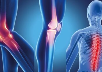 ‘Sessiz Hastalık’ Olarak Adlandırılan Osteoporoz Ciddi Bir Halk Sağlığı Sorunu Olarak Karşımıza Çıkıyor.